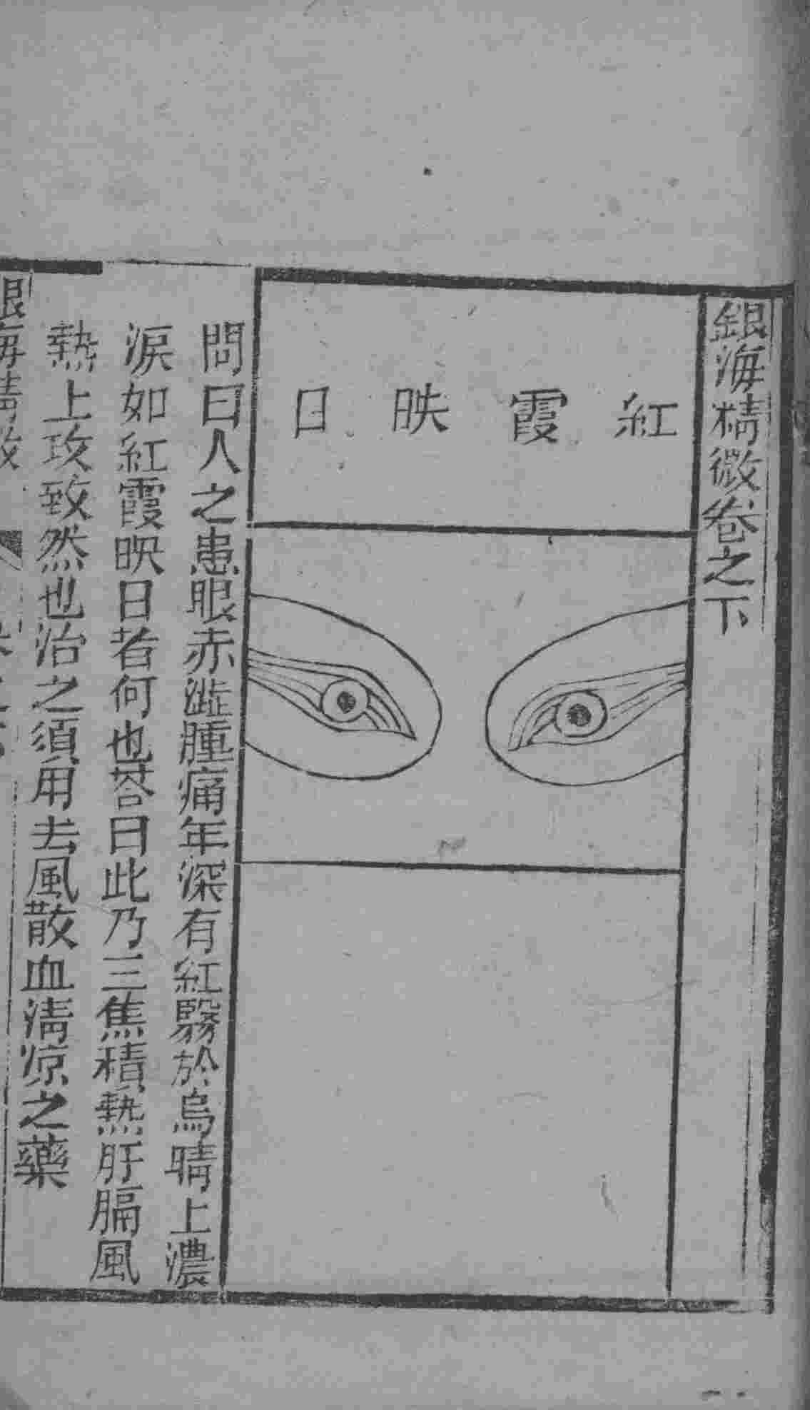 银海精微  卷下